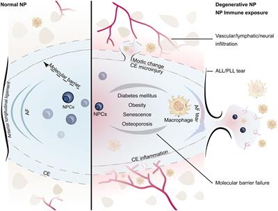 Immune exposure: how macrophages interact with the nucleus pulposus